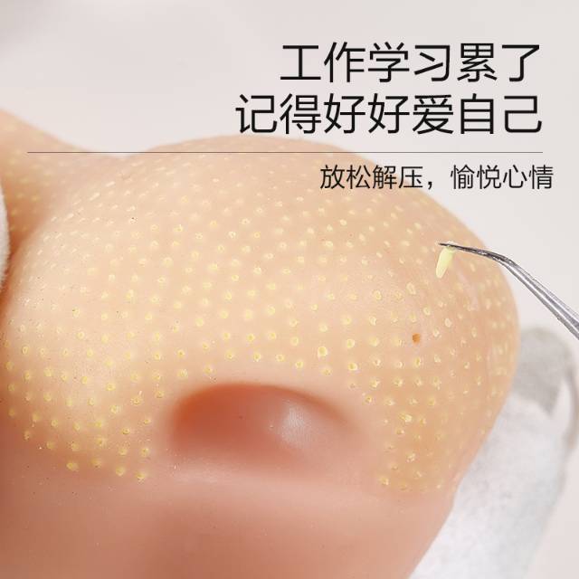 Strawberry nose.